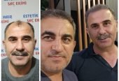 Saç Ekimi ( Fue Yöntemi )