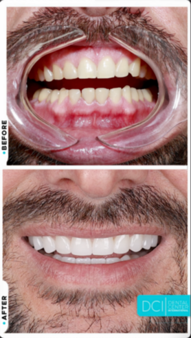 Smile Design