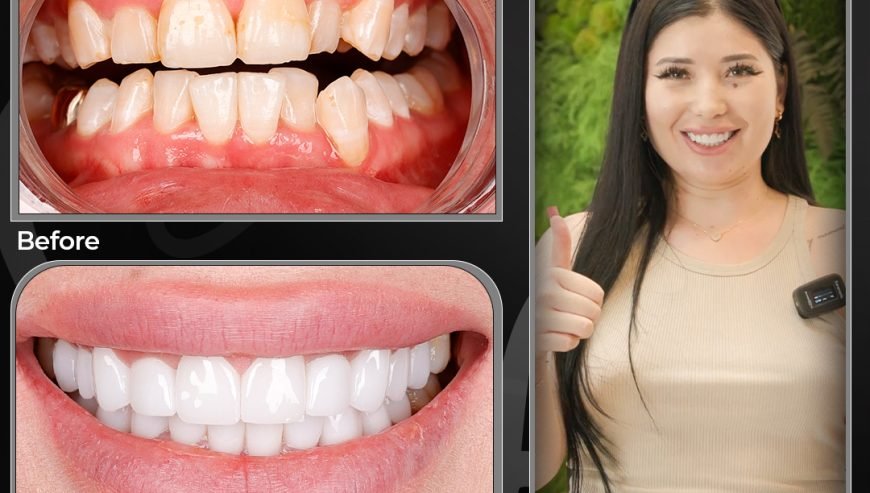 Smile Design